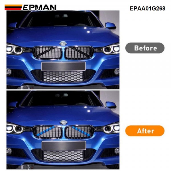 EPMAN Front Grille Kidney Brace Bars for BMW 3 Series E90/E91/E92/E93 2006-2013 EPAA01G268 EPMAN Front Grille Kidney Brace Bars for BMW 3 Series E90/E91/E92/E93 2006-2013 EPAA01G268